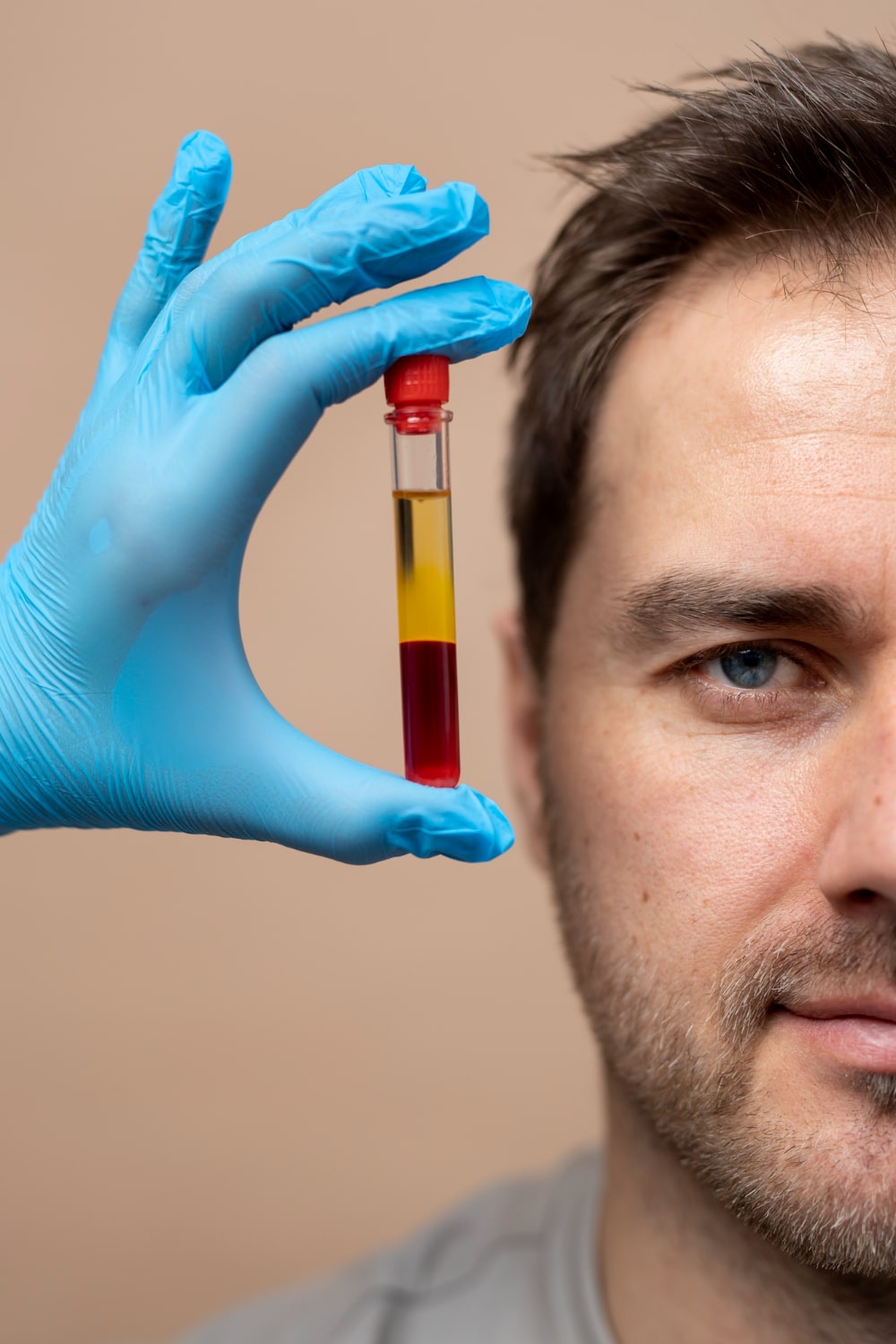 Top Benefits Platelet Rich Plasma - Biological Innovations