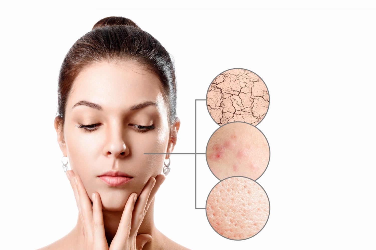 Healthy skin rejuvenation and dermatological benefits of iCCS treatment.
