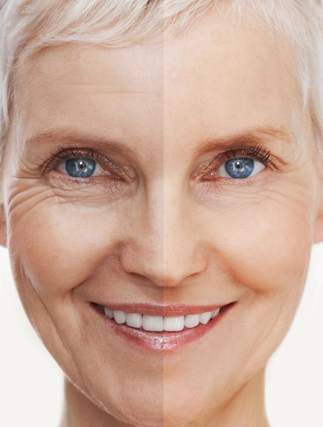 Visible anti-aging effects on skin after iCCS treatment.