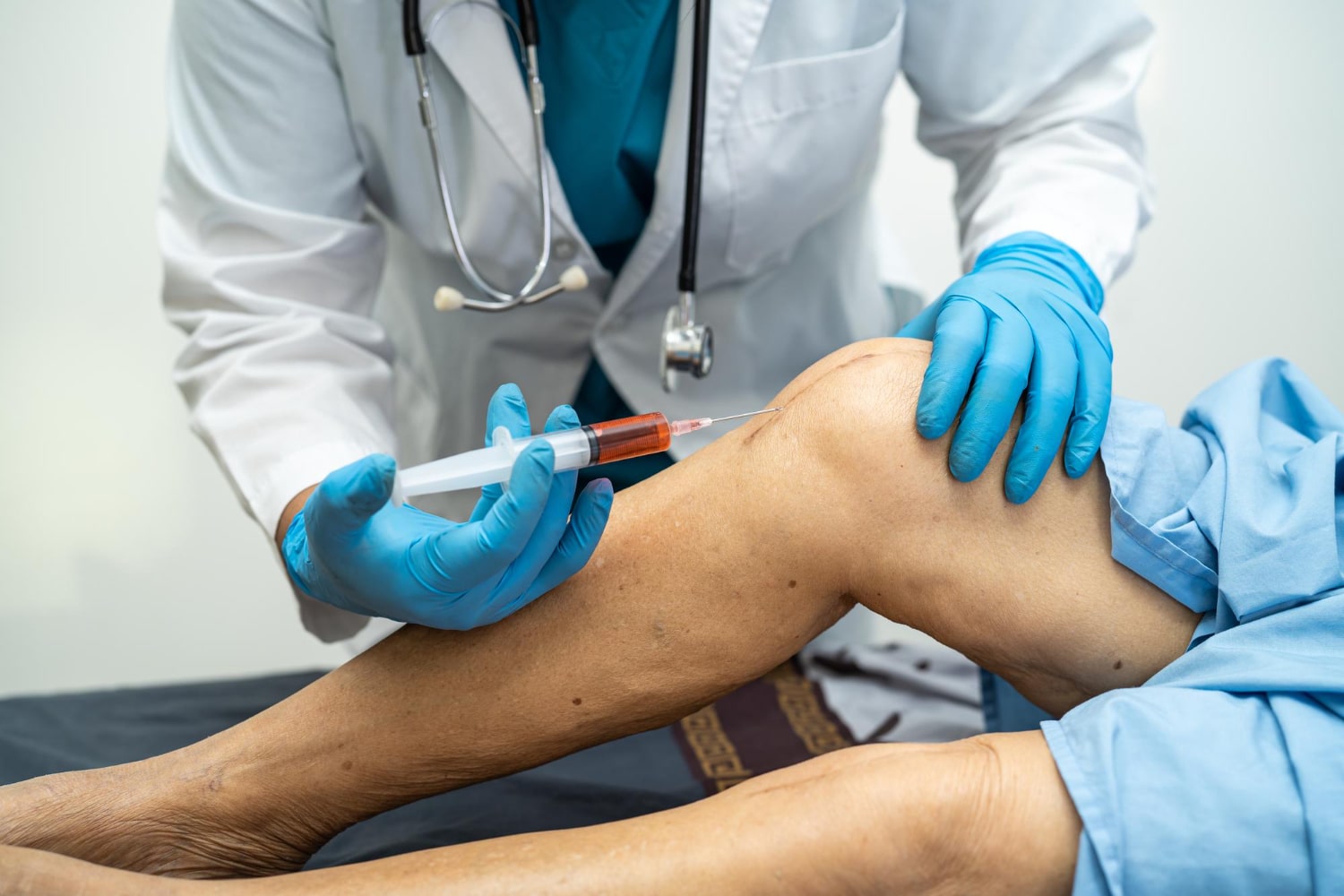 A medical professional administering platelet-rich plasma injection as part of ligament injuries.
