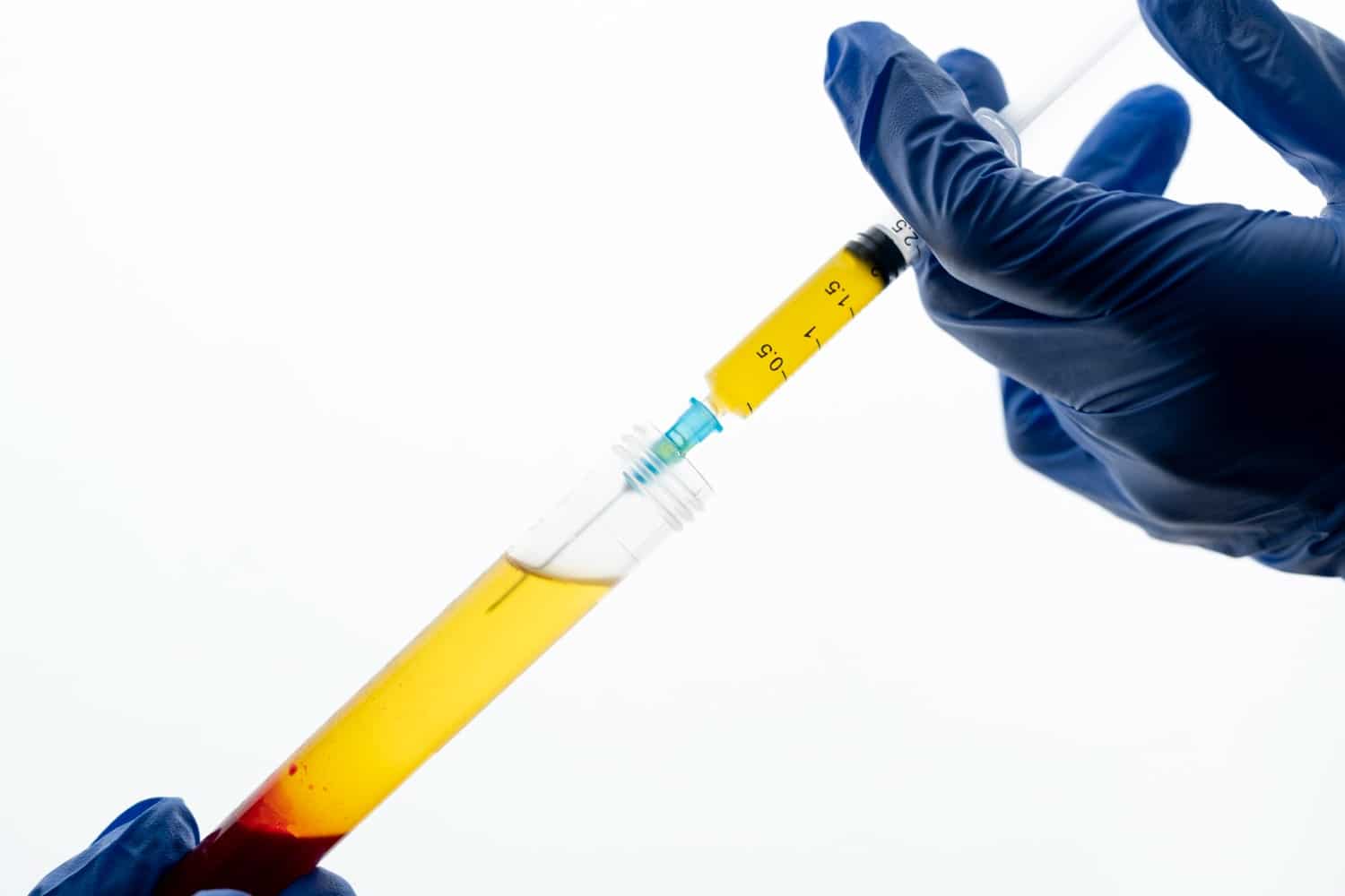 A detailed illustration of the preparation process of Injectable Platelet-Rich Fibrin, emphasizing the scientific approach and biological components.